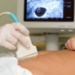 Puebla octavo lugar con más médicos contagiados de Coronavirus