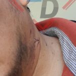 Localizan cadáver de una mujer con signos de violencia en la colonia Excursionista