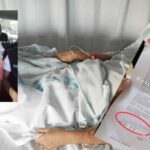 Suman 8 casos de viruela del mono en Puebla