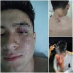 Trágico accidente en Zacatlán: un muerto y tres lesionados tras volcadura en barranca