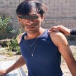 Motociclista resulta con lesiones graves tras chocar contra una camioneta en Izúcar de Matamoros